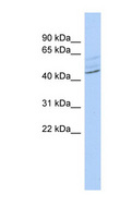 ZMYND12 Antibody - ZMYND12 antibody Western blot of OVCAR-3 cell lysate. This image was taken for the unconjugated form of this product. Other forms have not been tested.