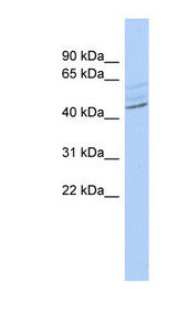 ZMYND12 Antibody - ZMYND12 antibody Western blot of OVCAR-3 cell lysate. This image was taken for the unconjugated form of this product. Other forms have not been tested.