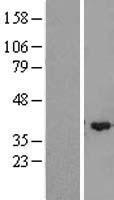 ZMYND12 Protein - Western validation with an anti-DDK antibody * L: Control HEK293 lysate R: Over-expression lysate