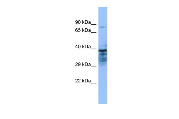 ZMYND15 Antibody - Western blot analysis of ZMYND15 expression in THP-1 whole cell lysate.  Anti-ZMYND15 antibody diluted at 1.0ug/ml.  This image was taken for the unconjugated form of this product. Other forms have not been tested.