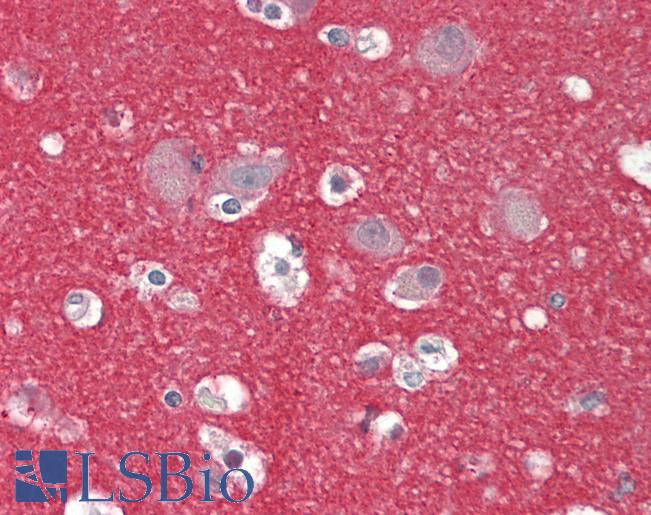 ZMYND15 Antibody - Human Brain, Cortex: Formalin-Fixed, Paraffin-Embedded (FFPE).  This image was taken for the unconjugated form of this product. Other forms have not been tested.