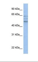 ZMYND17 Antibody - HepG2 cell lysate. Antibody concentration: 1.0 ug/ml. Gel concentration: 12%.  This image was taken for the unconjugated form of this product. Other forms have not been tested.