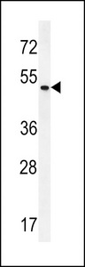 ZMYND17 Antibody - ZMYND17 Antibody western blot of HeLa cell line lysates (35 ug/lane). The ZMYND17 antibody detected the ZMYND17 protein (arrow).
