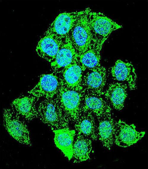 ZMYND17 Antibody - Confocal immunofluorescence of ZMYND17 Antibody with HeLa cell followed by Alexa Fluor 488-conjugated goat anti-rabbit lgG (green). DAPI was used to stain the cell nuclear (blue).