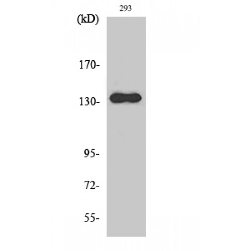 ZMYND8 / RACK7 Antibody - Western blot of RACK7 antibody