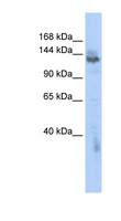 ZMYND8 / RACK7 Antibody - ZMYND8 / PRKCBP1 antibody Western blot of HeLa lysate. This image was taken for the unconjugated form of this product. Other forms have not been tested.