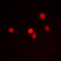 ZMYND8 / RACK7 Antibody - Immunofluorescent analysis of RACK7 staining in HeLa cells. Formalin-fixed cells were permeabilized with 0.1% Triton X-100 in TBS for 5-10 minutes and blocked with 3% BSA-PBS for 30 minutes at room temperature. Cells were probed with the primary antibody in 3% BSA-PBS and incubated overnight at 4 deg C in a humidified chamber. Cells were washed with PBST and incubated with a DyLight 594-conjugated secondary antibody (red) in PBS at room temperature in the dark. DAPI was used to stain the cell nuclei (blue).
