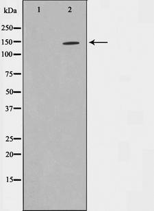 ZMYND8 / RACK7 Antibody - Western blot analysis on 293 cell lysates using PKCB1 antibody. The lane on the left is treated with the antigen-specific peptide.