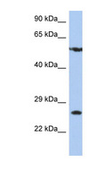 ZNF10 / KOX1 Antibody - ZNF10 antibody Western blot of HT1080 cell lysate. This image was taken for the unconjugated form of this product. Other forms have not been tested.