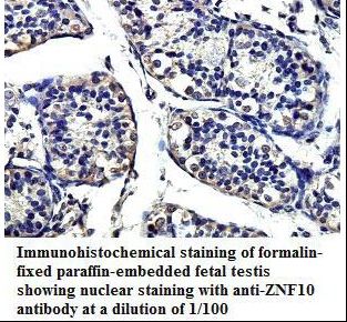 ZNF10 / KOX1 Antibody