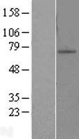 ZNF10 / KOX1 Protein - Western validation with an anti-DDK antibody * L: Control HEK293 lysate R: Over-expression lysate