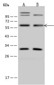 ZNF100 Antibody - Anti-ZNF100 rabbit polyclonal antibody at 1:500 dilution. Lane A: Jurkat Whole Cell Lysate. Lane B: U-251 MG Whole Cell Lysate. Lysates/proteins at 30 ug per lane. Secondary: Goat Anti-Rabbit IgG (H+L)/HRP at 1/10000 dilution. Developed using the ECL technique. Performed under reducing conditions. Predicted band size: 62 kDa. Observed band size: 62 kDa. (We are unsure as to the identity of these extra bands.)