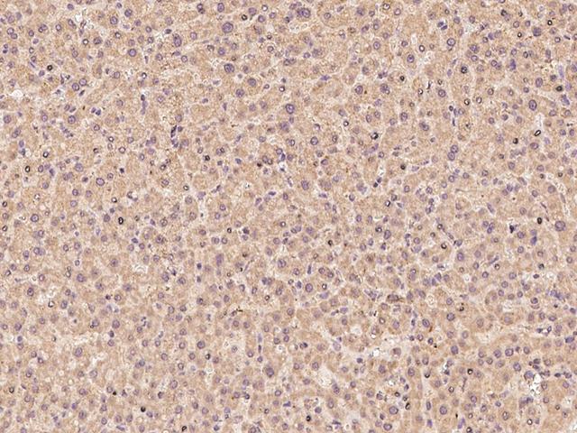 ZNF100 Antibody - Immunochemical staining of human ZNF100 in human liver with rabbit polyclonal antibody at 1:100 dilution, formalin-fixed paraffin embedded sections.