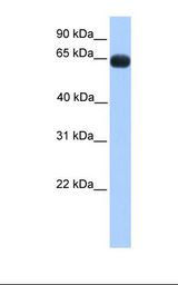 ZNF100 Antibody - Fetal muscle lysate. Antibody concentration: 1.0 ug/ml. Gel concentration: 12%.  This image was taken for the unconjugated form of this product. Other forms have not been tested.