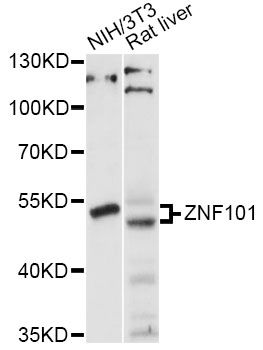 ZNF101 Antibody - Western blot analysis of extracts of various cell lines, using ZNF101 antibody at 1:1000 dilution. The secondary antibody used was an HRP Goat Anti-Rabbit IgG (H+L) at 1:10000 dilution. Lysates were loaded 25ug per lane and 3% nonfat dry milk in TBST was used for blocking. An ECL Kit was used for detection and the exposure time was 30s.