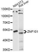 ZNF101 Antibody - Western blot analysis of extracts of various cell lines, using ZNF101 antibody at 1:1000 dilution. The secondary antibody used was an HRP Goat Anti-Rabbit IgG (H+L) at 1:10000 dilution. Lysates were loaded 25ug per lane and 3% nonfat dry milk in TBST was used for blocking. An ECL Kit was used for detection and the exposure time was 30s.