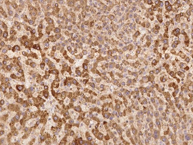 ZNF101 Antibody - Immunochemical staining of human ZNF101 in human liver with rabbit polyclonal antibody at 1:100 dilution, formalin-fixed paraffin embedded sections.