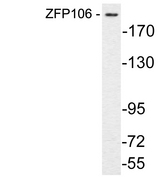 ZNF106 / ZFP106 Antibody - Western blot analysis of lysate from COS7 cells, using ZFP106 antibody.