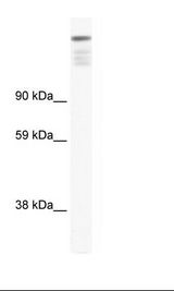 ZNF106 / ZFP106 Antibody - Fetal Skeletal Muscle Lysate.  This image was taken for the unconjugated form of this product. Other forms have not been tested.