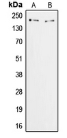 ZNF106 / ZFP106 Antibody - Western blot analysis of ZFP106 expression in HeLa (A); COS7 (B) whole cell lysates.