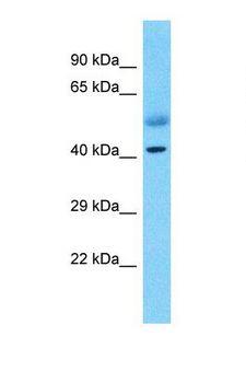 ZNF114 Antibody - Western blot of Human Lung Tumor. ZNF114 antibody dilution 1.0 ug/ml.  This image was taken for the unconjugated form of this product. Other forms have not been tested.