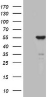 ZNF114 Antibody - HEK293T cells were transfected with the pCMV6-ENTRY control. (Left lane) or pCMV6-ENTRY ZNF114. (Right lane) cDNA for 48 hrs and lysed. Equivalent amounts of cell lysates. (5 ug per lane) were separated by SDS-PAGE and immunoblotted with anti-ZNF114. (1:2000)