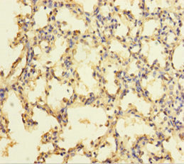 ZNF114 Antibody - Immunohistochemistry of paraffin-embedded human lung tissue using ZNF114 Antibody at dilution of 1:100