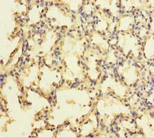 ZNF114 Antibody - Immunohistochemistry of paraffin-embedded human lung tissue using ZNF114 Antibody at dilution of 1:100