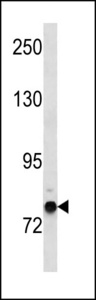 ZNF12 Antibody - ZNF12 Antibody western blot of NCI-H292 cell line lysates (35 ug/lane). The ZNF12 antibody detected the ZNF12 protein (arrow).