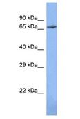 ZNF12 Antibody - ZNF12 antibody Western Blot of 721_B. Antibody dilution: 1 ug/ml.  This image was taken for the unconjugated form of this product. Other forms have not been tested.