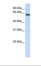 ZNF131 Antibody - 721_B cell lysate. Antibody concentration: 1.0 ug/ml. Gel concentration: 12%.  This image was taken for the unconjugated form of this product. Other forms have not been tested.
