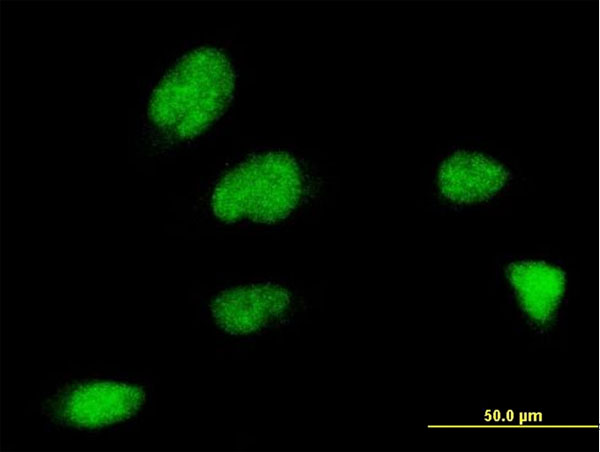 ZNF131 Antibody - Immunofluorescence of monoclonal antibody to ZNF131 on HeLa cell . [antibody concentration 10 ug/ml]