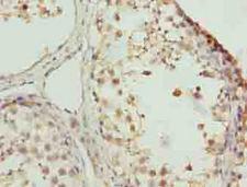 ZNF131 Antibody - Immunohistochemistry of paraffin-embedded human testis tissue using antibody at dilution of 1:100.