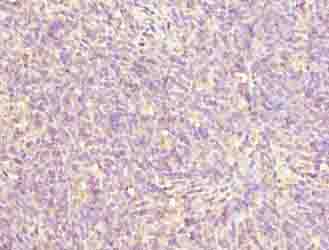 ZNF131 Antibody - Immunohistochemistry of paraffin-embedded human thymus tissue using antibody at dilution of 1:100.