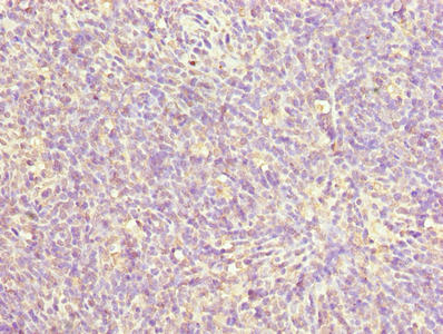 ZNF131 Antibody - Immunohistochemistry of paraffin-embedded human thymus tissue using ZNF131 Antibody at dilution of 1:100