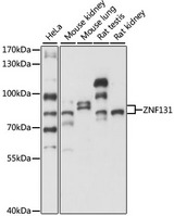 ZNF131 Antibody - Western blot analysis of extracts of various cell lines, using ZNF131 antibody at 1:1000 dilution. The secondary antibody used was an HRP Goat Anti-Rabbit IgG (H+L) at 1:10000 dilution. Lysates were loaded 25ug per lane and 3% nonfat dry milk in TBST was used for blocking. An ECL Kit was used for detection and the exposure time was 5s.