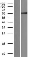ZNF131 Protein - Western validation with an anti-DDK antibody * L: Control HEK293 lysate R: Over-expression lysate