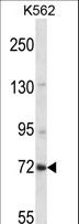 ZNF132 Antibody - ZNF132 Antibody western blot of K562 cell line lysates (35 ug/lane). The ZNF132 antibody detected the ZNF132 protein (arrow).