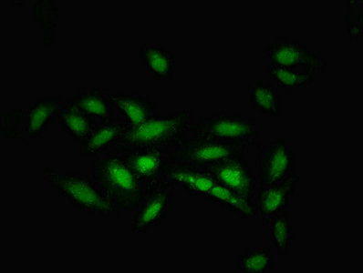 ZNF133 Antibody - Immunofluorescent analysis of Hela cells using ZNF133 Antibody at dilution of 1:100 and Alexa Fluor 488-congugated AffiniPure Goat Anti-Rabbit IgG(H+L)
