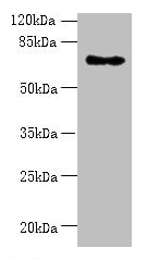 ZNF133 Antibody - Western blot All lanes: ZNF133 antibody at 5µg/ml + Hela whole cell lysate Secondary Goat polyclonal to rabbit IgG at 1/10000 dilution Predicted band size: 74, 63, 67 kDa Observed band size: 74 kDa