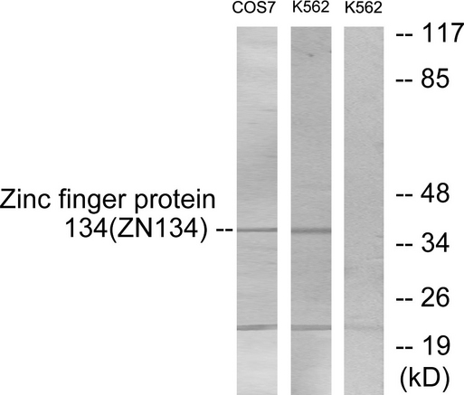 ZNF134 Antibody - Western blot analysis of lysates from COS7 and K562 cells, using ZNF134 Antibody. The lane on the right is blocked with the synthesized peptide.