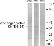 ZNF134 Antibody - Western blot analysis of lysates from COS7 and K562 cells, using ZNF134 Antibody. The lane on the right is blocked with the synthesized peptide.