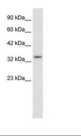 ZNF134 Antibody - HepG2 Cell Lysate.  This image was taken for the unconjugated form of this product. Other forms have not been tested.