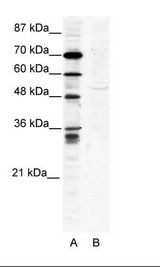 ZNF134 Antibody - A: Marker, B: HepG2 Cell Lysate.  This image was taken for the unconjugated form of this product. Other forms have not been tested.