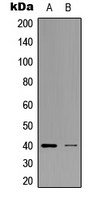 ZNF134 Antibody - Western blot analysis of ZNF134 expression in K562 (A); HEK293T (B) whole cell lysates.