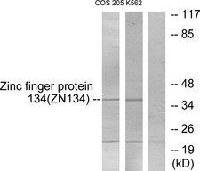 ZNF134 Antibody - Western blot analysis of extracts from COS-7 cells and K562 cells, using ZNF134 antibody.