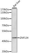 ZNF134 Antibody - Western blot analysis of extracts of rat liver using ZNF134 Polyclonal Antibody at dilution of 1:1000.