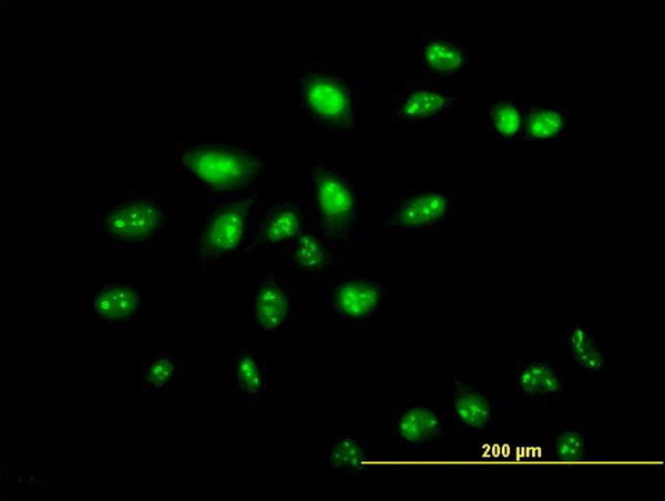 ZNF136 Antibody - Immunofluorescence of monoclonal antibody to ZNF136 on HeLa cell. [antibody concentration 10 ug/ml]