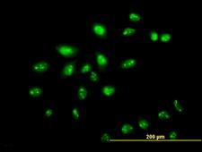 ZNF136 Antibody - Immunofluorescence of monoclonal antibody to ZNF136 on HeLa cell. [antibody concentration 10 ug/ml]