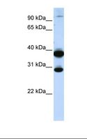 ZNF138 Antibody - Fetal muscle lysate. Antibody concentration: 1.0 ug/ml. Gel concentration: 12%.  This image was taken for the unconjugated form of this product. Other forms have not been tested.
